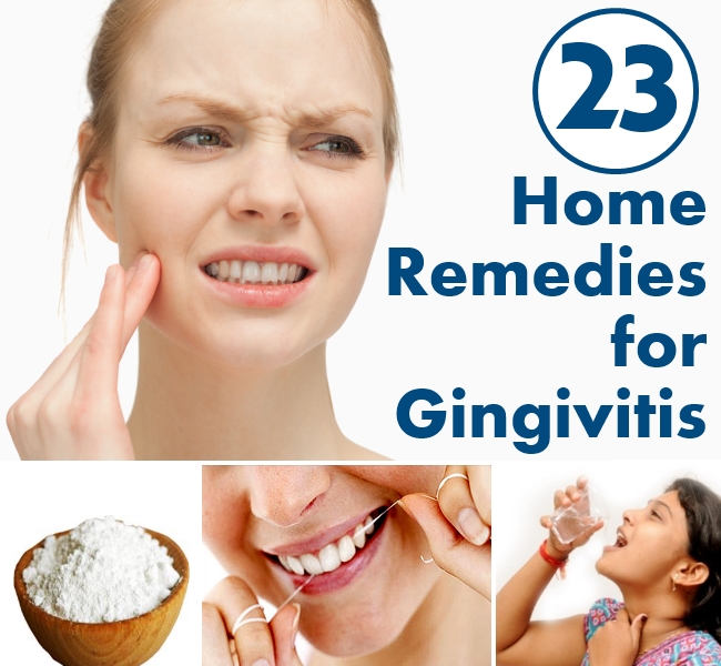 23 Home Remedies for Gingivitis